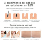 Depilador Láser Ipl